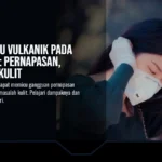 Dampak Abu Vulkanik pada Kesehatan: Pernapasan, Mata, dan Kulit Ini Langkah Pencegahan dan Perlindungan Diri